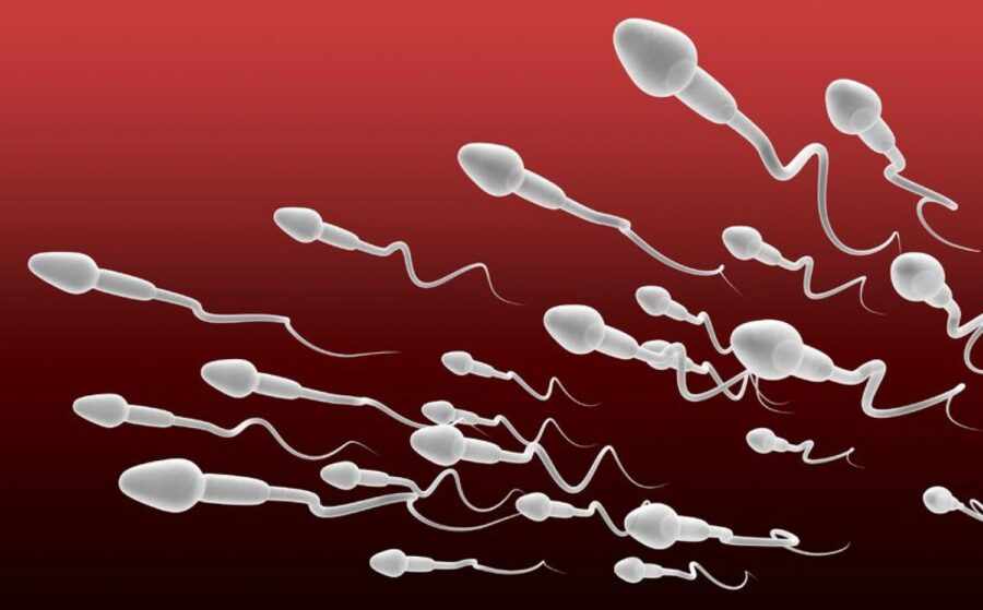 много сперматозоидов